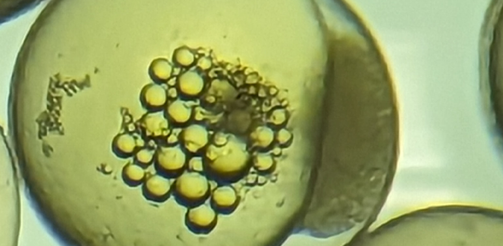 A closeup of a multi-celled fish eggs with lipid bubles